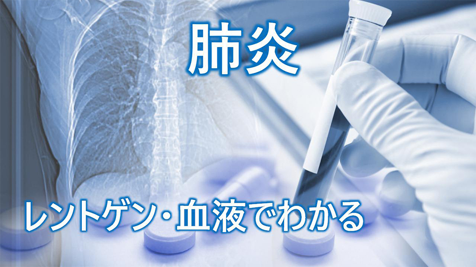 肺炎