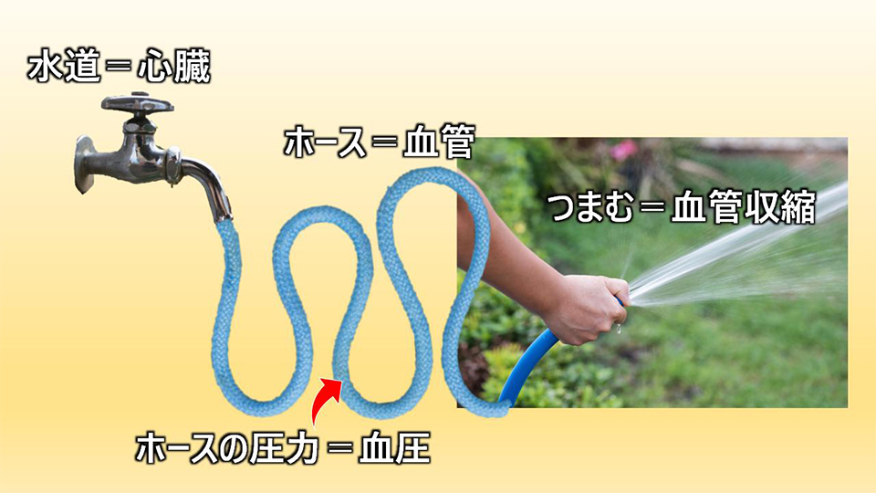 高血圧のイメージ