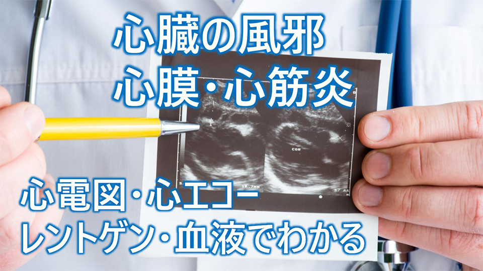 心膜炎・心筋炎